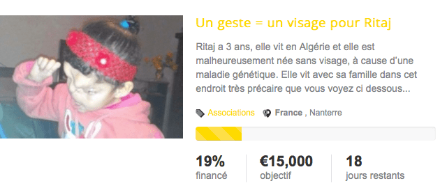 Solidarité : Un geste pour reconstruire le visage de Ritaj