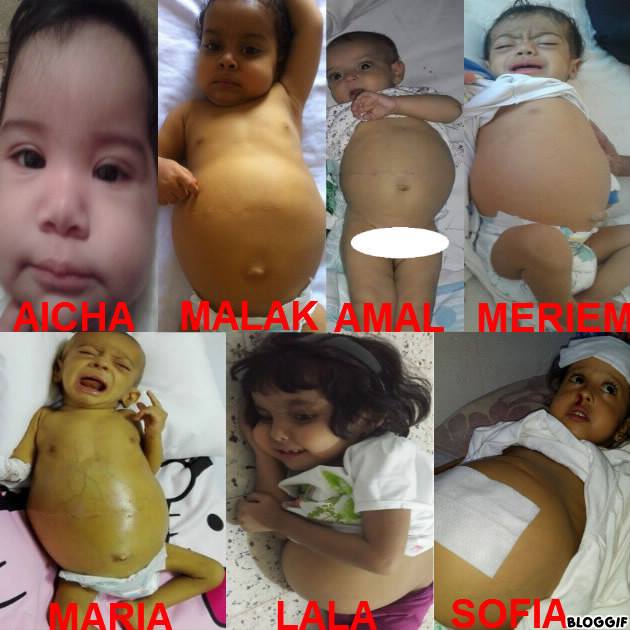 Edito du 25/07/2016 - #Collectes : Aidons ces enfants à rester en vie ! A nos #dons !